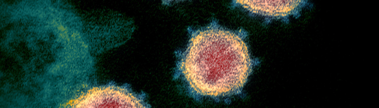 Header image: Microscopy image showing SARS-CoV-2